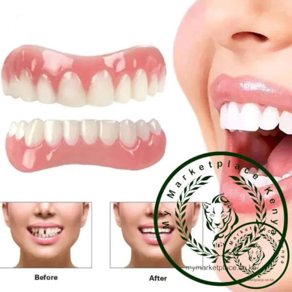The Fourth Generation of Denture Stickers, Silicone Simulation Teeth Braces, Whitening Teeth Stickers, Smiling Dentures - Image 2